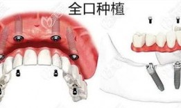 佛山种牙爆料事件最新情况,最新进展与各方回应梳理