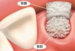 佛山种牙爆料事件最新情况,最新进展与各方回应梳理