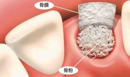 佛山种牙爆料事件最新情况,最新进展与各方回应梳理